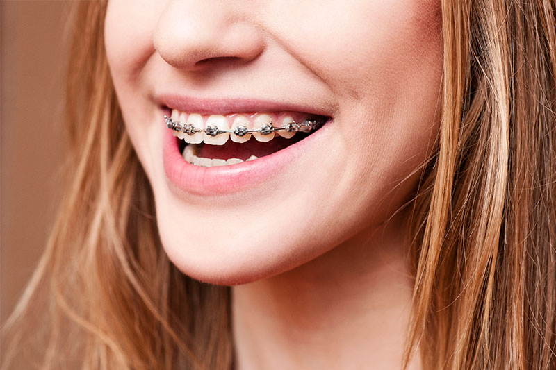 Orthodontics in Lakewood